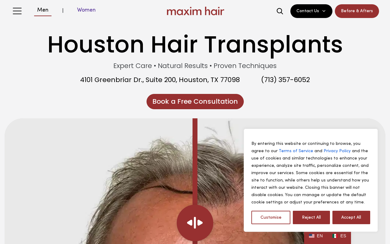 Maxim Hair Restoration — screenshot of their official website